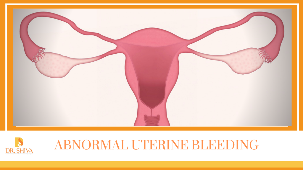 Abnormal Uterine Bleeding Symptoms Causes And Treatment Dr Shiva 5988