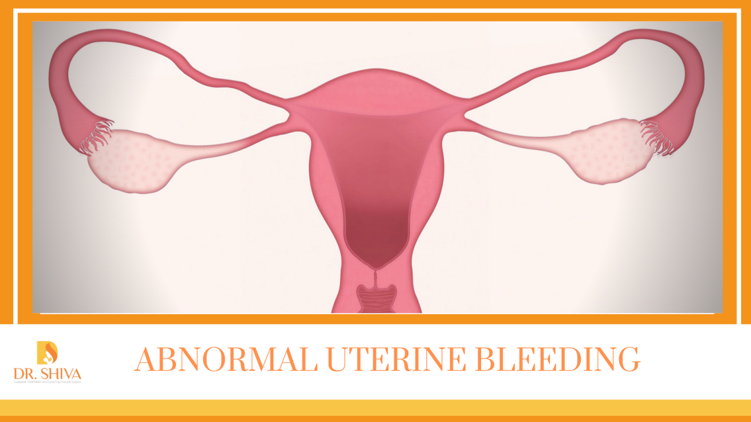 abnormal-uterine-bleeding-symptoms-causes-and-treatment-dr-shiva