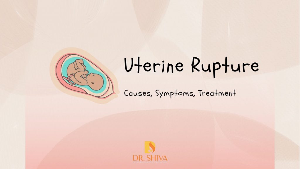 uterine-rupture-childbirth-complications-treatment