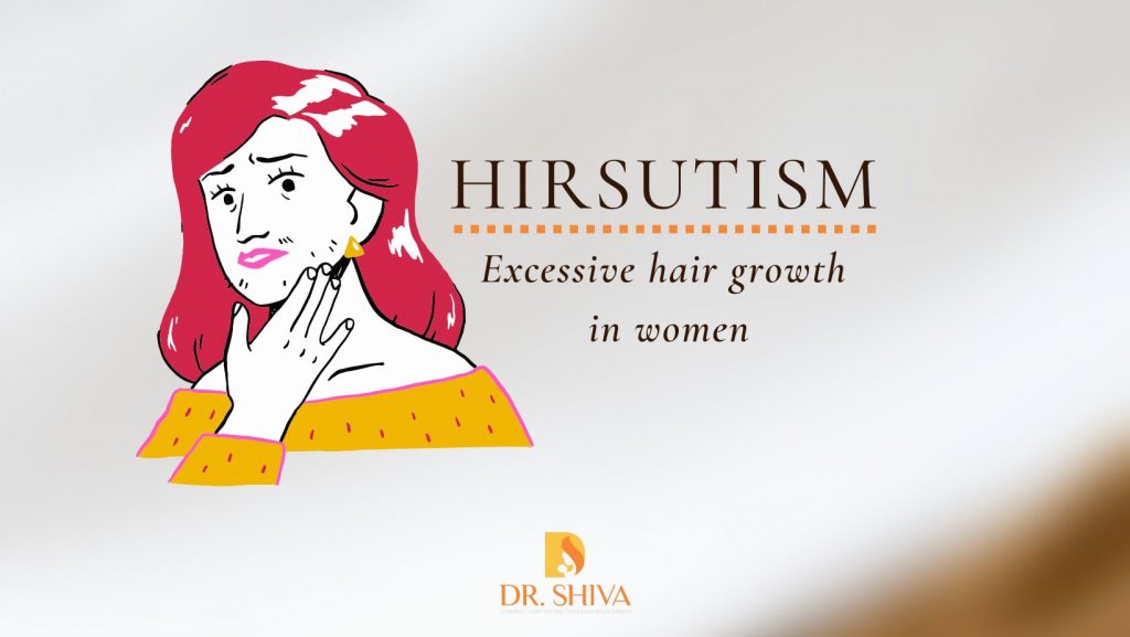 hirsutism-causes-symptoms-diagnosis-treatment-excessive-hair-growth